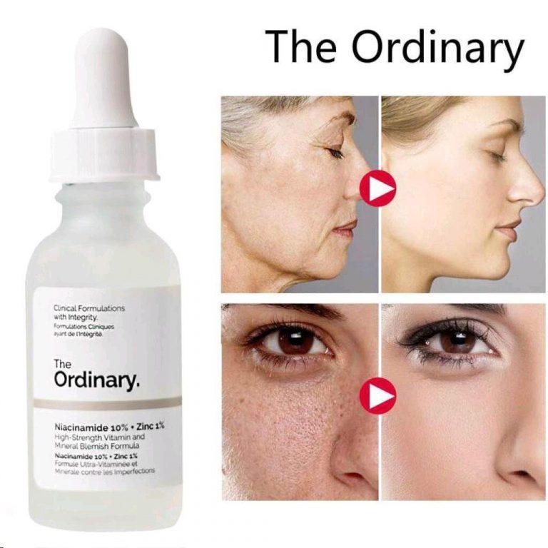 Niacinamide Serum For Brightening & Anti-Acne Skin Care